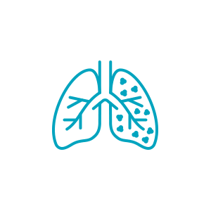 慢性閉塞性肺疾患（COPD）